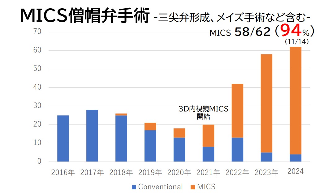 MICS 僧帽弁術手術件数　-三尖弁形成、メイズ手術を含む 