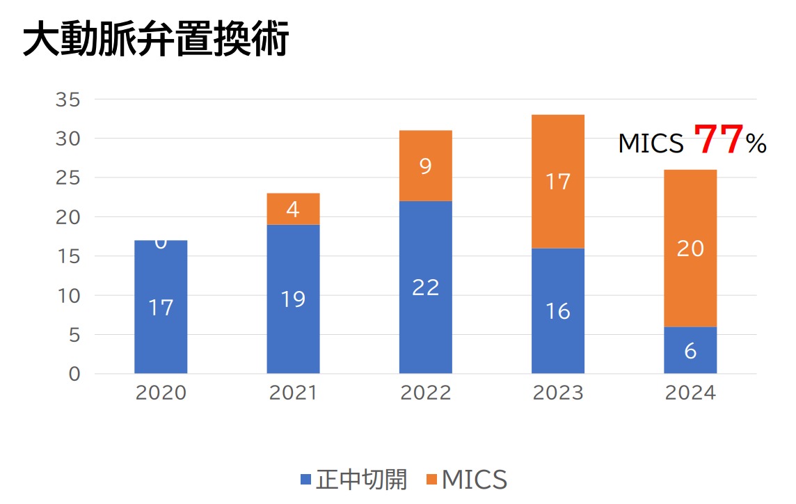 MICS 大動脈弁置換術